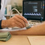 Varice comment les enlever : écho-doppler, sclérothérapie, laser ou chirurgie